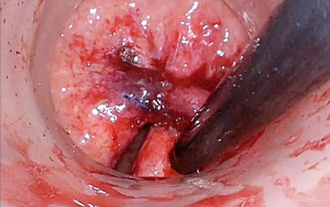 Click on image to zoom