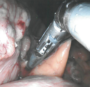 Click on image to zoom