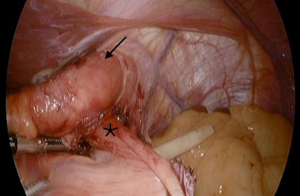 Click on image to zoom