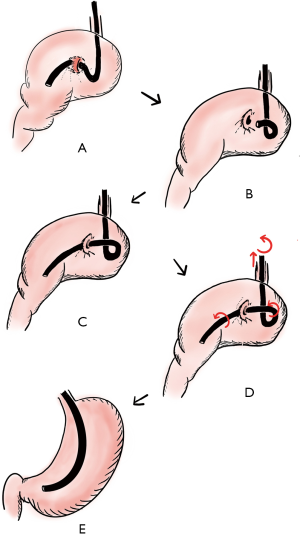 Click on image to zoom