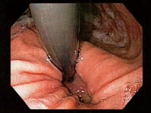 Click on image to zoom