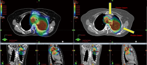 Click on image to zoom