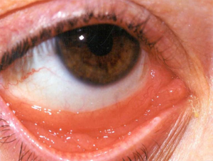 Click on image to zoom