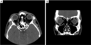 Click on image to zoom