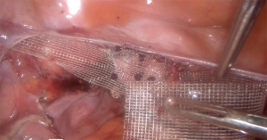 Click on image to zoom