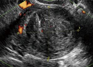 Click on image to zoom