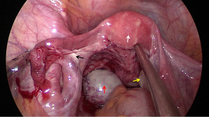 Click on image to zoom