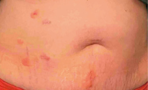 Click on image to zoom
