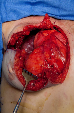 Click on image to zoom