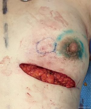 Click on image to zoom