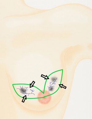 Click on image to zoom