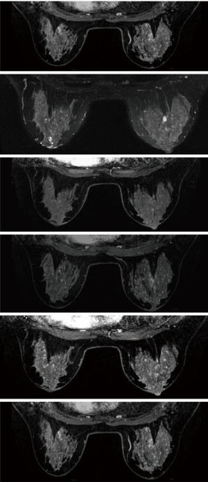 Figure 26