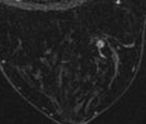 Click on image to zoom Figure 32