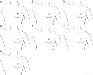 Click on image to zoom