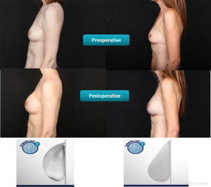 Click on image to zoom