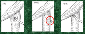Click on image to zoom