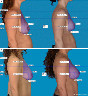 Click on image to zoom