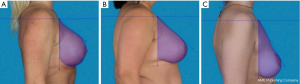 Click on image to zoom