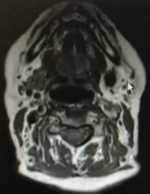 Click on image to zoom