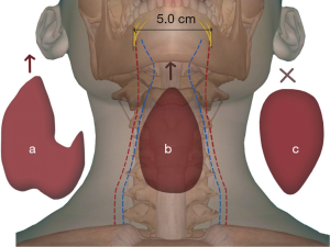Click on image to zoom