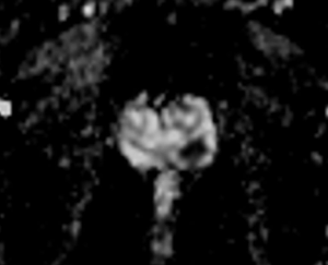 Click on image to zoom