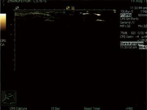 Click on image to zoom