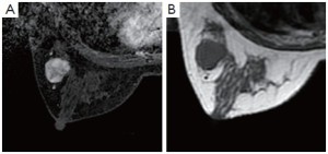 Click on image to zoom Figure 14