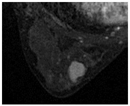 Click on image to zoom Figure 35