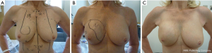 Click on image to zoom