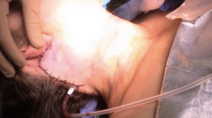 Click on image to zoom