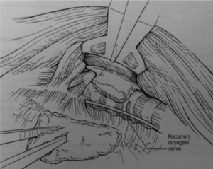 Click on image to zoom