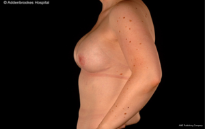 Click on image to zoom