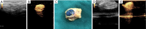 Click on image to zoom