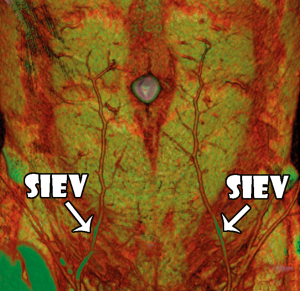 Click on image to zoom