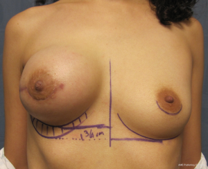 Click on image to zoom