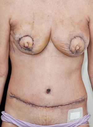Click on image to zoom