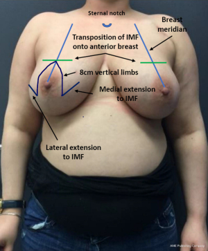 Click on image to zoom