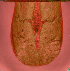Click on image to zoom