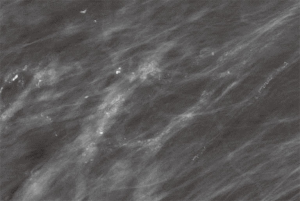 Click on image to zoom