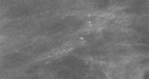 Click on image to zoom