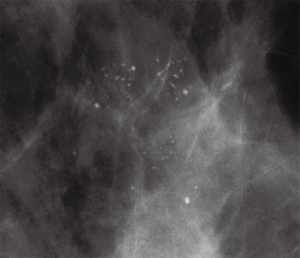 Click on image to zoom