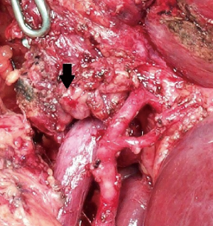 Click on image to zoom