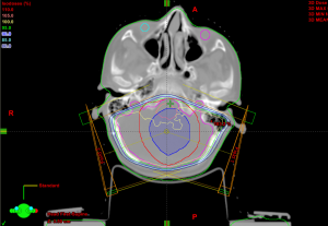 Click on image to zoom