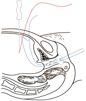 Click on image to zoom