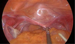 Click on image to zoom