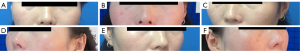 Click on image to zoom