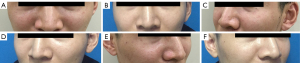 Click on image to zoom