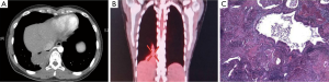 Click on image to zoom