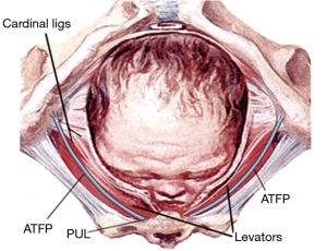 Click on image to zoom