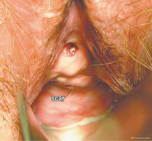 Click on image to zoom